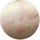 ���ݷ���Ƥ����ҽԺ