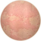 ���ݷ���Ƥ����ҽԺ