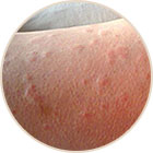 ���ݷ���Ƥ����ҽԺ