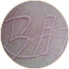 ���ݷ���Ƥ����ҽԺ