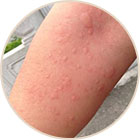 ���ݷ���Ƥ����ҽԺ