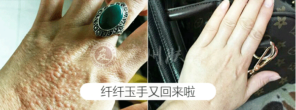 ���ݷ���Ƥ����ҽԺ