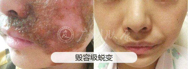 ���ݷ���Ƥ����ҽԺ