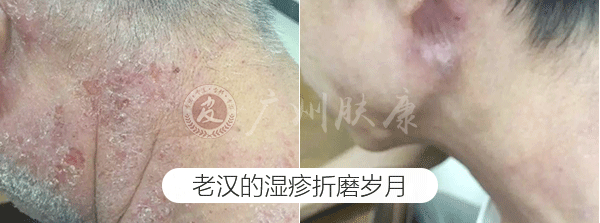 ���ݷ���Ƥ����ҽԺ