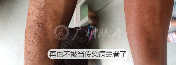 ���ݷ���Ƥ����ҽԺ