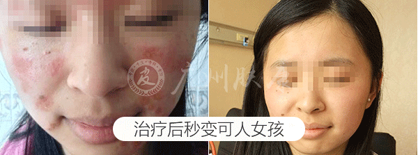 ���ݷ���Ƥ����ҽԺ