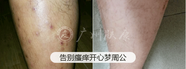 ���ݷ���Ƥ����ҽԺ