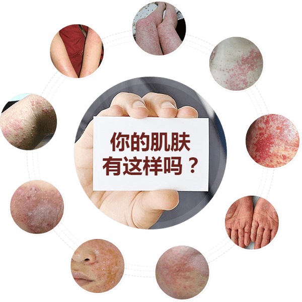 ���ݷ���Ƥ����ҽԺ