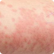 ���ݷ���Ƥ����ҽԺ