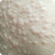 ���ݷ���Ƥ����ҽԺ