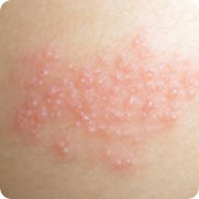 ���ݷ���Ƥ����ҽԺ