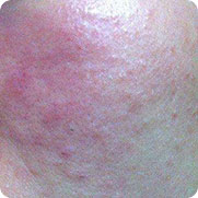 ���ݷ���Ƥ����ҽԺ