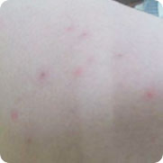 ���ݷ���Ƥ����ҽԺ