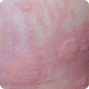 ���ݷ���Ƥ����ҽԺ