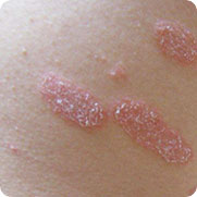 ���ݷ���Ƥ����ҽԺ